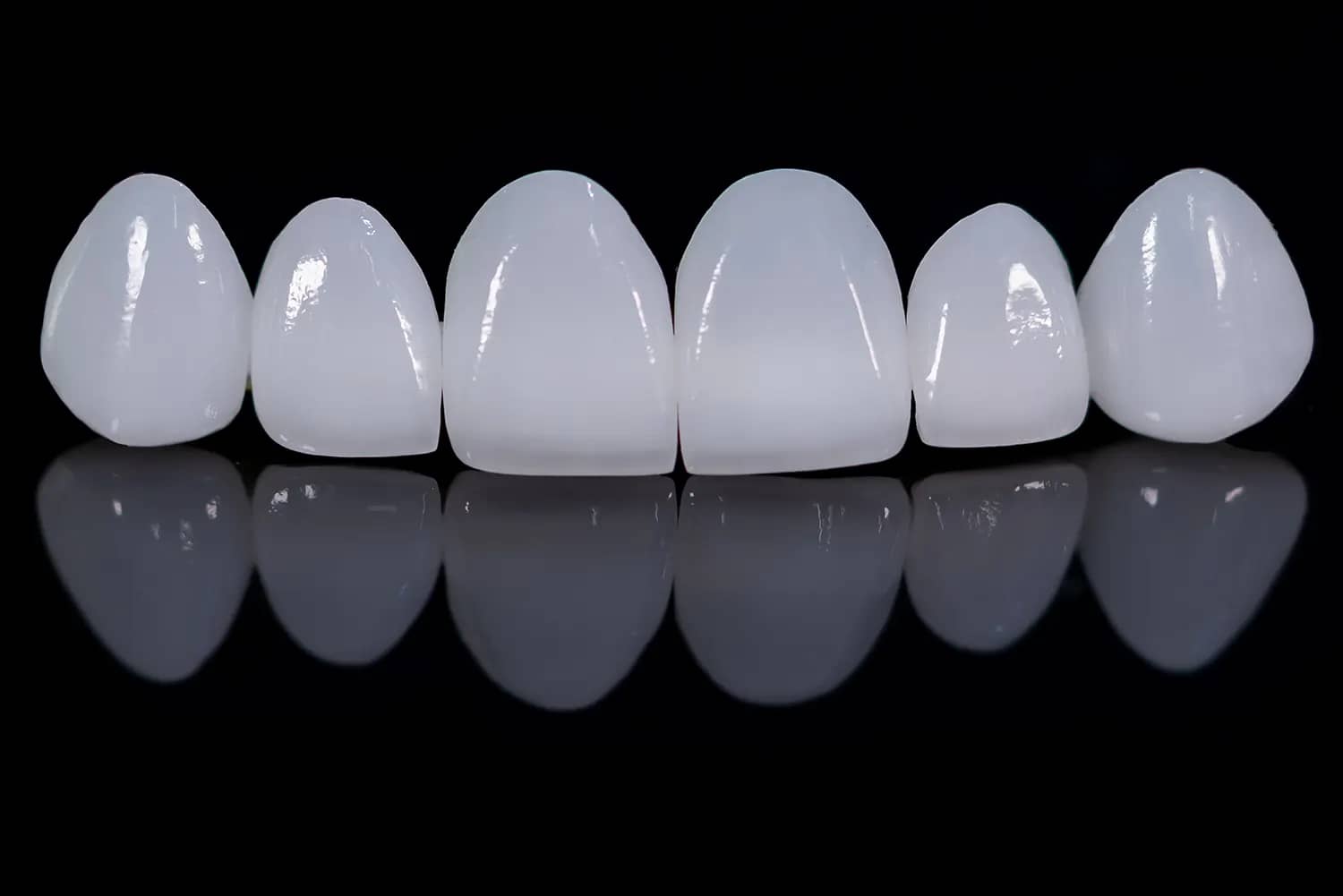 The Difference between Dental Bonding and Veneers |